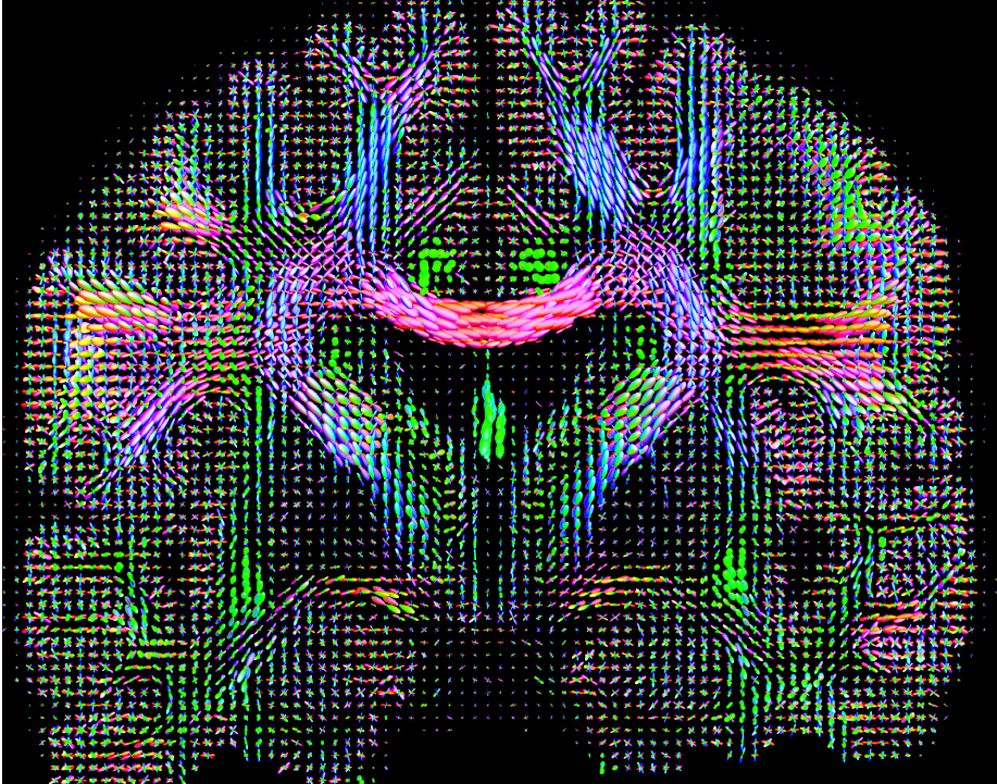 An up-close view of ALS