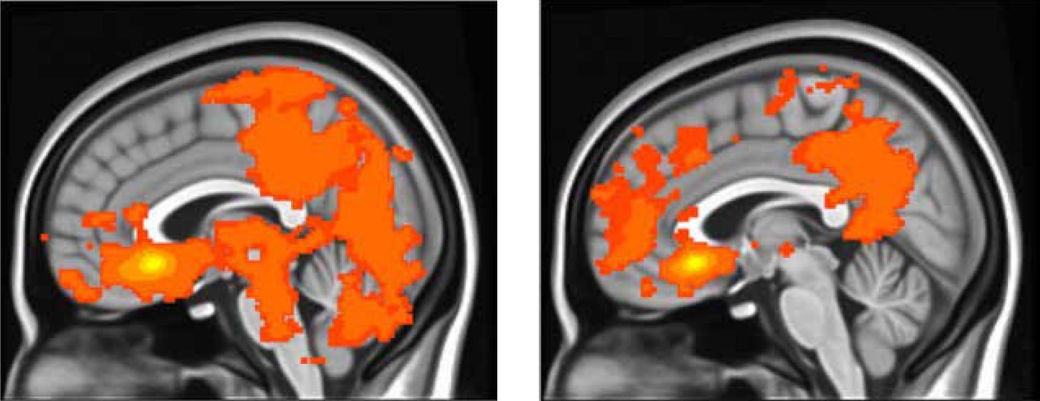 Camchong-brain-scans-2.jpg