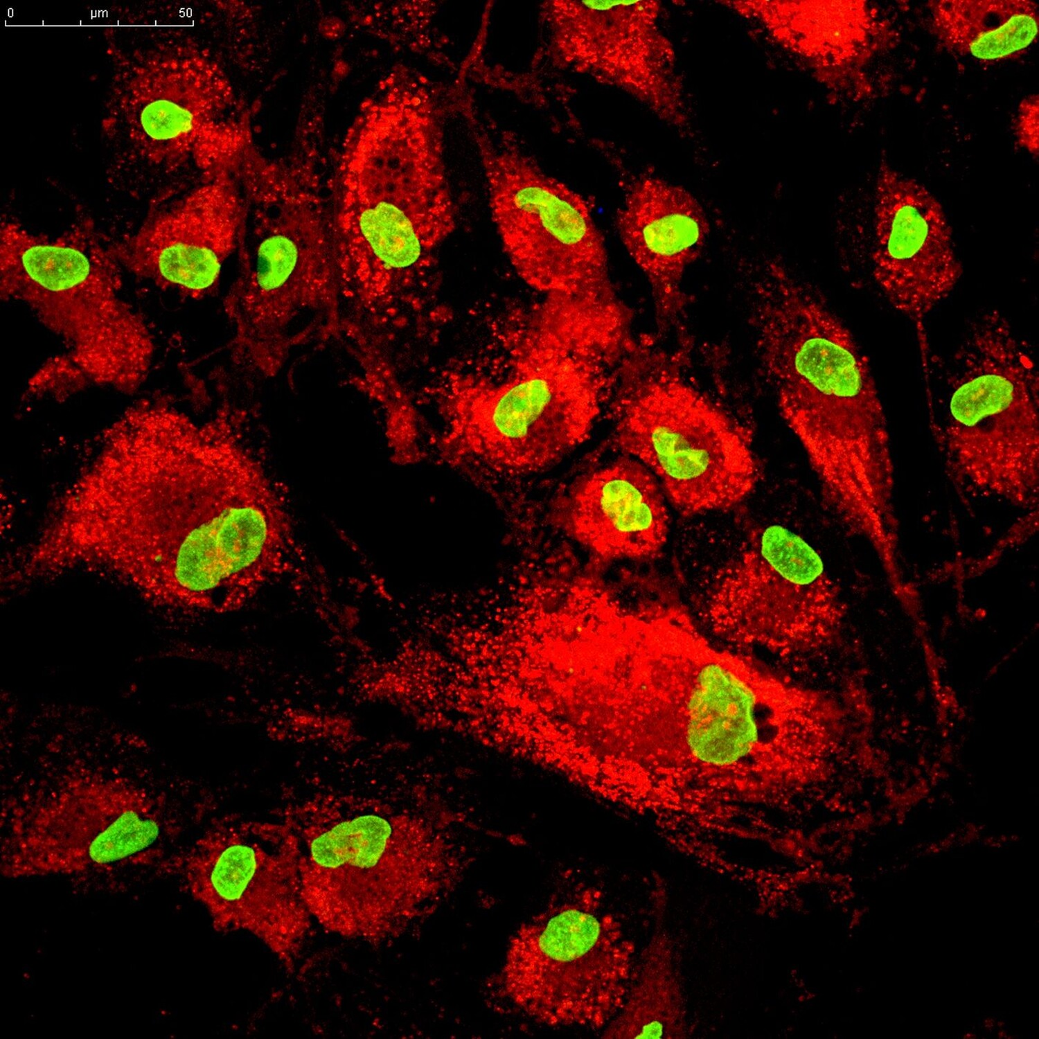 A red and green microscopic image of mesenchymal stem cells 