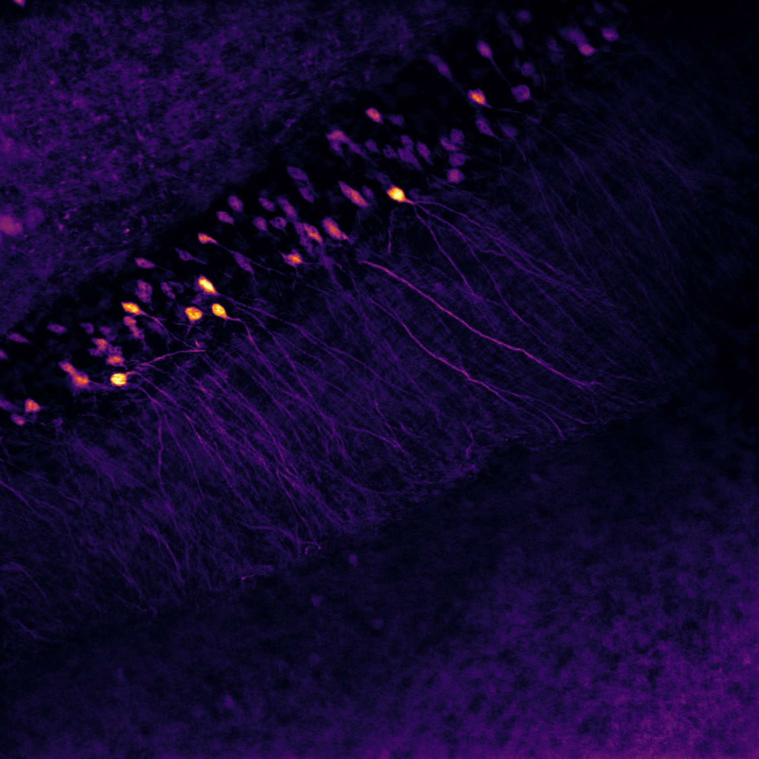 hippocampal-neuronsrgb.tif