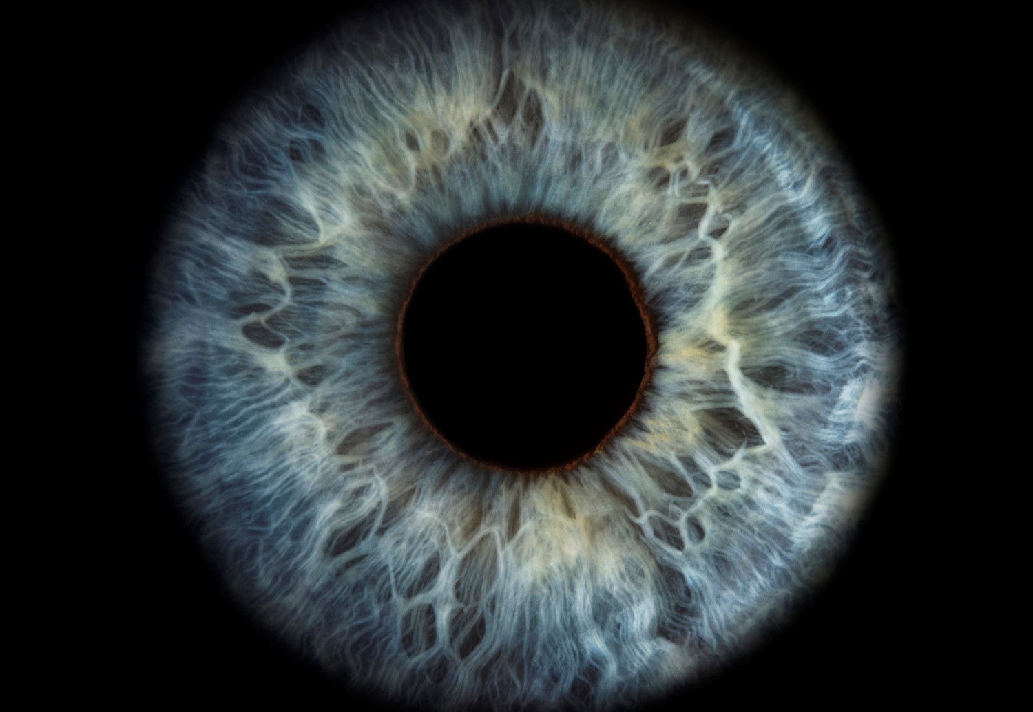 retina-5.jpg